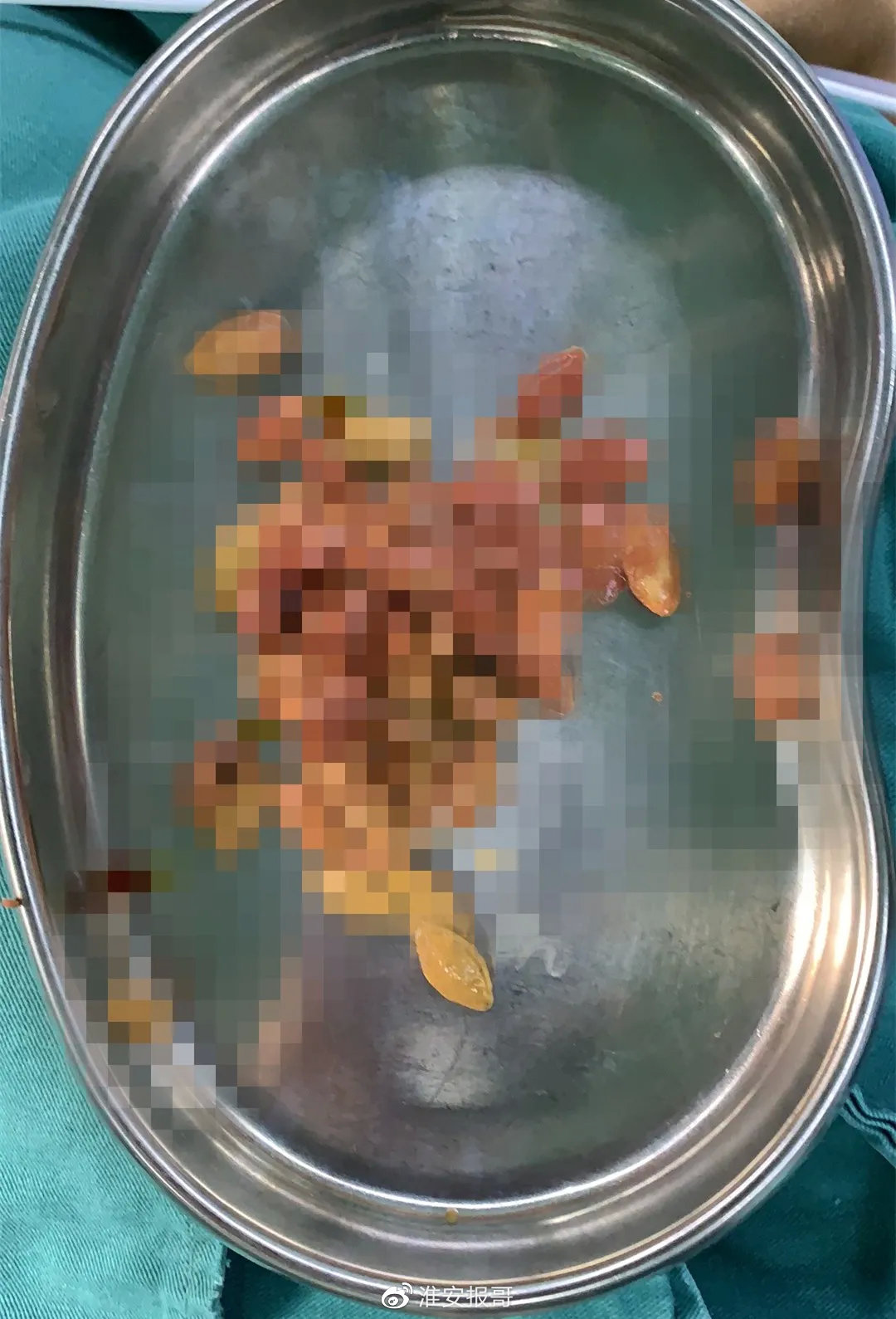 006XPvN7ly4gquec1hzu3j30u0185mzl.jpg 006XPvN7ly4gquec1hzu3j30u0185mzl.jpg