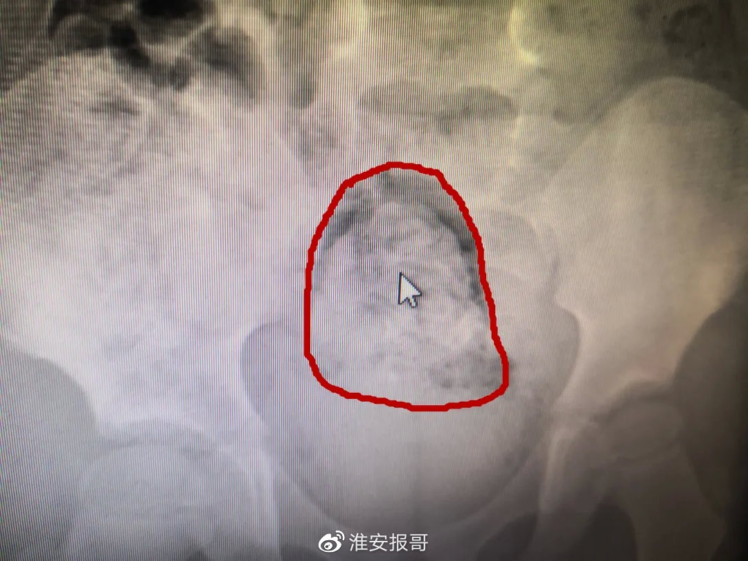 006XPvN7ly4gquec1ascdj30u00miju0.jpg 006XPvN7ly4gquec1ascdj30u00miju0.jpg